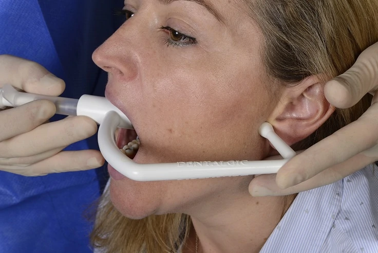 L’embout rétro-mandibulaire de l'angulateur est appliqué contre le bord postérieur de la branche mandibulaire, juste sous l'incisure inter-tragienne de l'oreille.